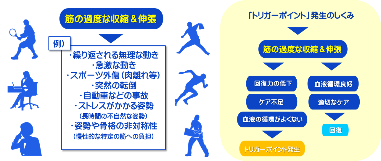 富士見台カイロプラクティックセンター/トリガーポイント発生のしくみ