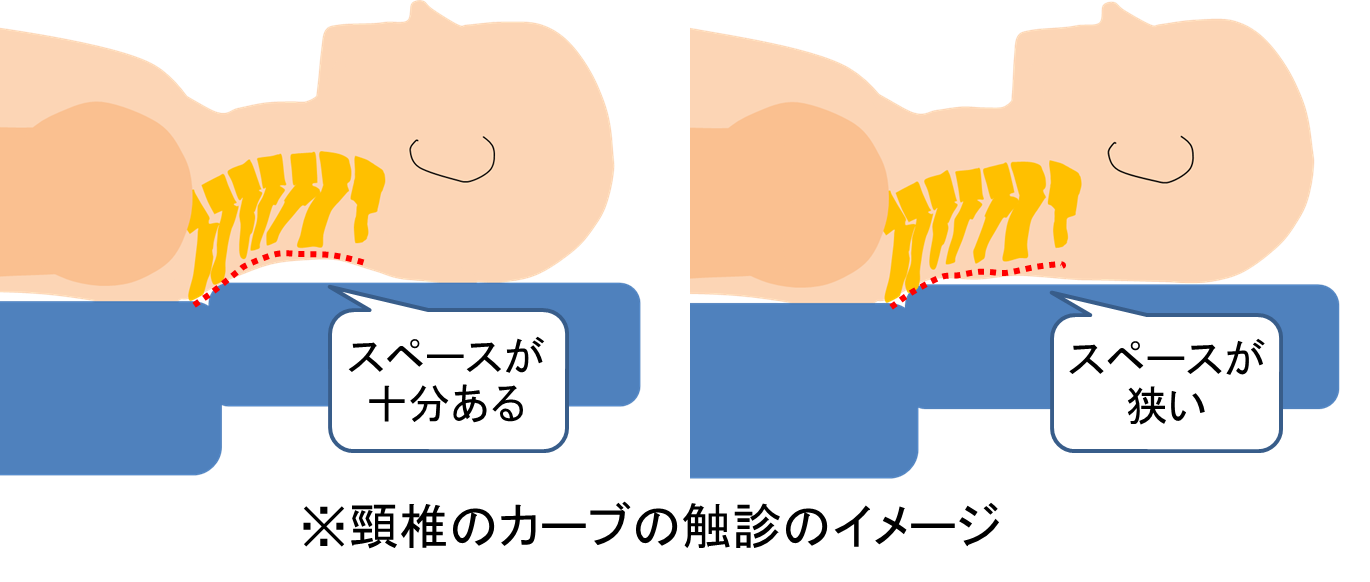 富士見台カイロプラクティックセンター／頸椎のカーブ／ストレートネック