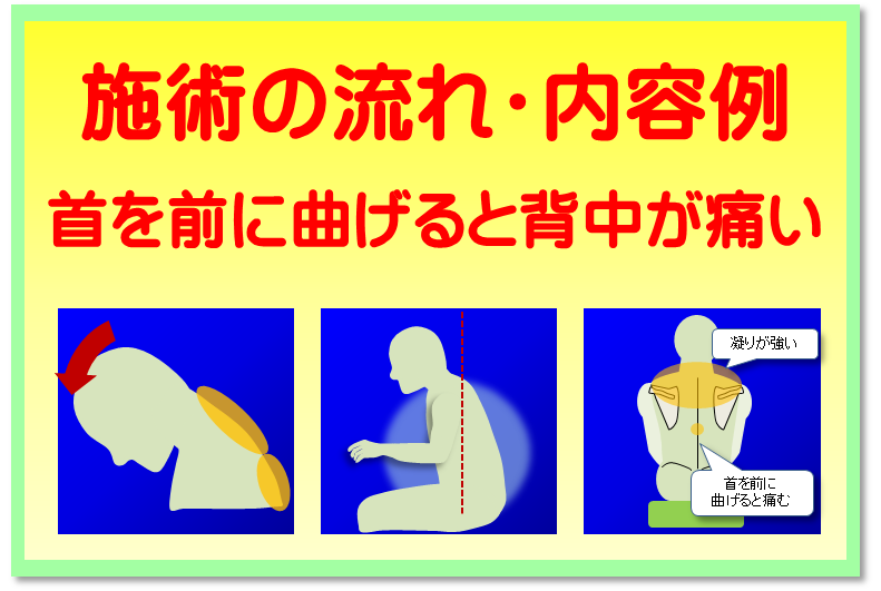 首を前に曲げると背中が痛い／初回の施術