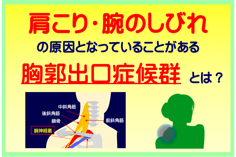 胸郭出口症候群