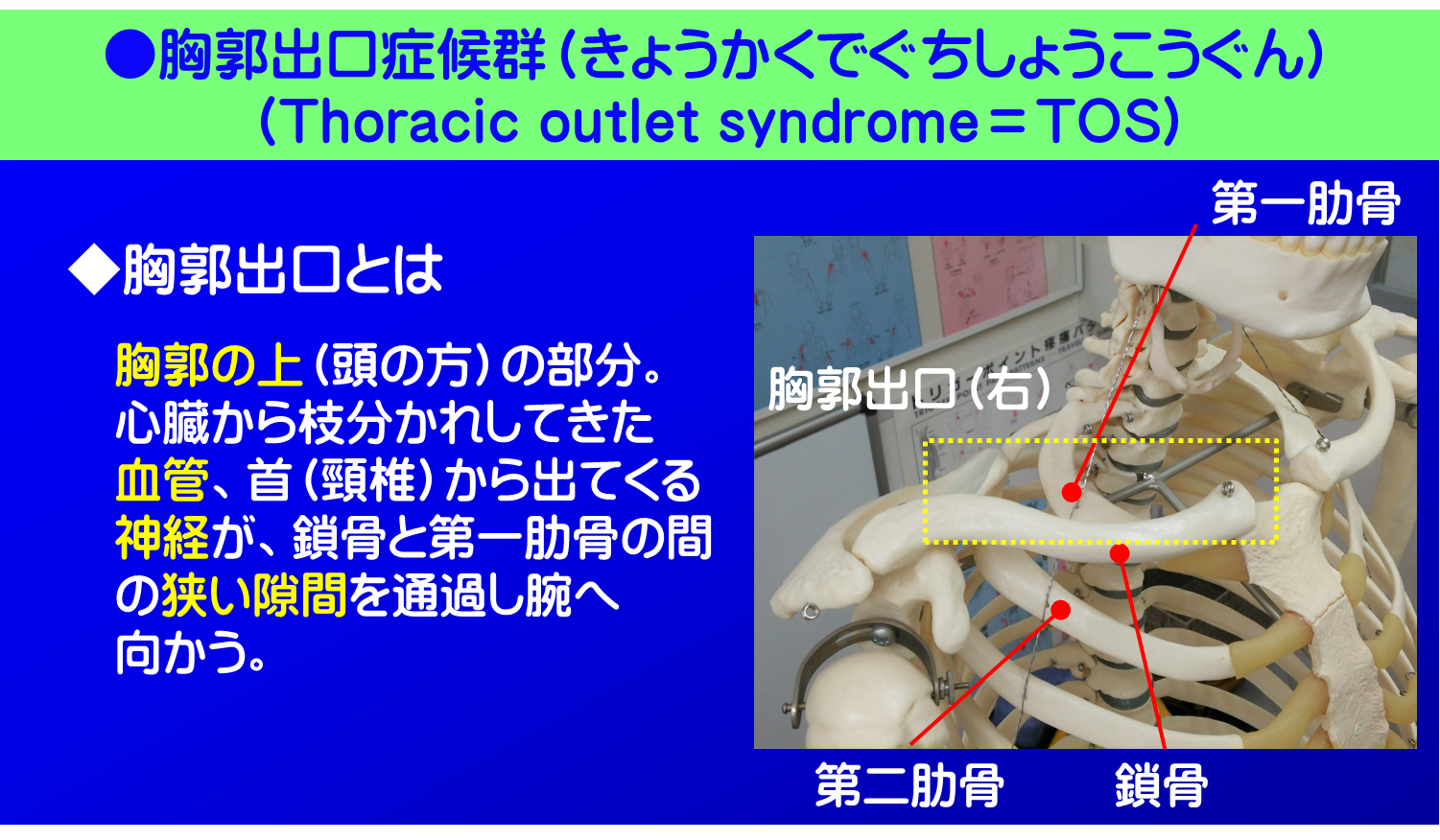 胸郭出口症候群／胸郭出口とは