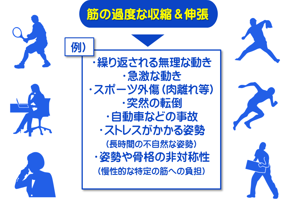 トリガーポイント発生のしくみ／富士見台カイロプラクティックセンター
