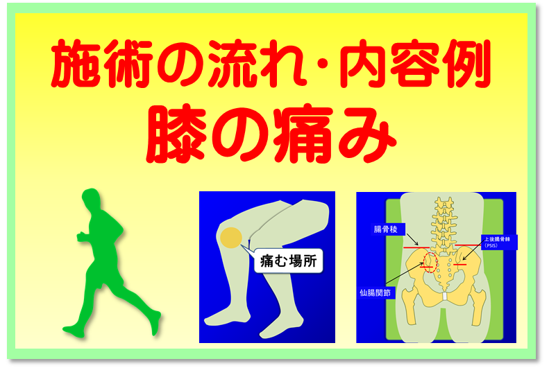 施術の流れ・内容例／膝の痛み　のページ作りました。