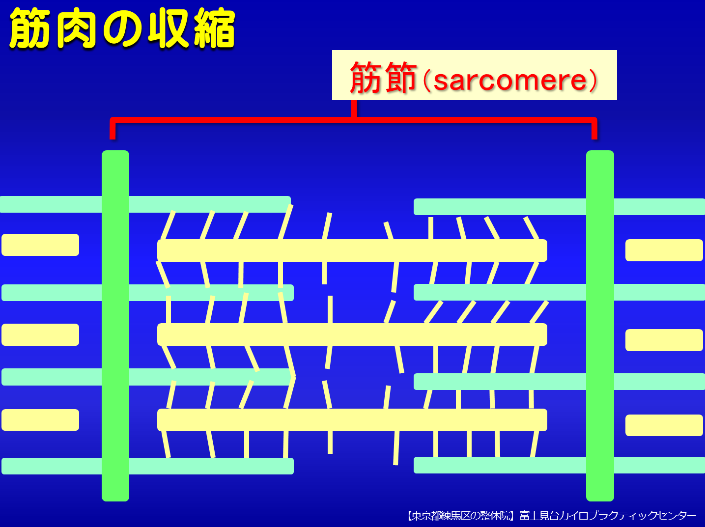 筋肉の収縮/トリガーポイント形成のしくみ／富士見台カイロプラクティックセンター