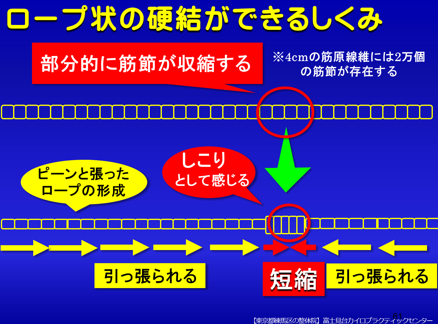 筋肉の収縮/トリガーポイント形成のしくみ／富士見台カイロプラクティックセンター