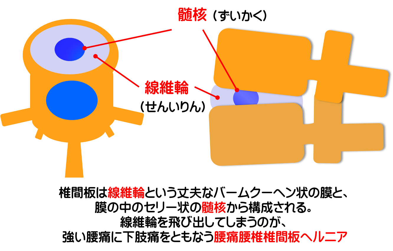 椎間板の働きを知って腰痛・椎間板ヘルニアを予防／富士見台カイロプラクティックセンター